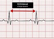 How To Read ECG Report?