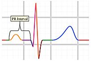 https://sunfox.in/blogs/understanding-the-pr-interval/