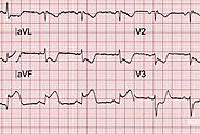 IWMI Full Form in Medical: A Comprehensive Guide