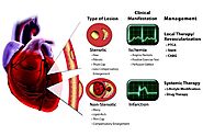 Understanding the Pathophysiology of Coronary Artery Disease