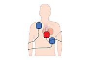 Cardioversion vs Defibrillation: Understanding the Differences and Their Role in Heart Health