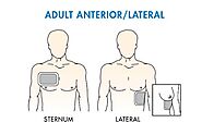 Defibrillator Pad Placement: A Comprehensive Guide