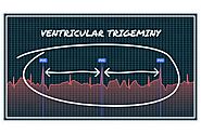 Understanding the Significance of Ventricular Trigeminy in Heart Health