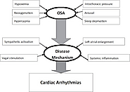 Understanding the Pathophysiology of Cardiac Arrhythmia