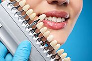 Boost Confidence with Cosmetic Dentistry in Scottsdale | Pinnacle Peak Dentistry