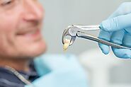 Step-by-Step Guide For Your Tooth Extraction Appointment | Pinnacle Peak Dentistry