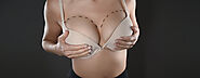 Some Most Common Breast Augmentation Risks