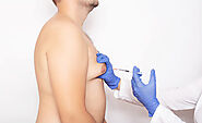 Gynecomastia Surgery Cost in Delhi