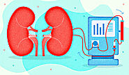 Dialysis - Yashoda Hospital Know Everything About Dialysis