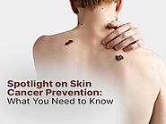 Spotlight on Skin Cancer Prevention: What You Need to Know