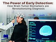 The Power of Early Detection: How Brain Tumor Biomarkers are Revolutionizing Diagnosis