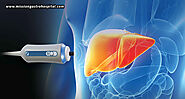 FibroScan – Managing Chronic Liver Diseases With Precision And Ease - Mission Gastro Hospital