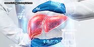 Reversing Fatty Liver with Expert Solutions