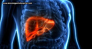Managing Chronic Liver Disease