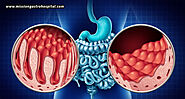 Understanding Coeliac Disease – Symptoms, Diagnosis & Management
