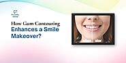 How Gum Contouring Enhances a Smile Makeover?