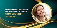 Understanding the Cost of Dental Crowns in London: What You Need to Know – Dawn Magazine