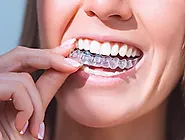 Invisible Braces London - Invisible Adult Braces Cost