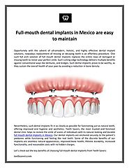 Full-mouth dental implants in Mexico are easy to maintain