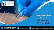 Top 6 Conditions Treated Effectively with Dry Needling