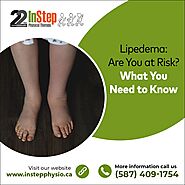 Lipedema: Are You At Risk? What You Need To Know