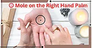 Knowing about Mole on the right hand palm through palmistry