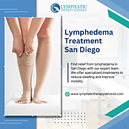 Lymphedema Treatment San Diego