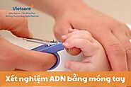 Xét nghiệm ADN bằng móng tay có chính xác không?