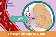 Xét nghiệm ADN thai nhi gồm những phương pháp nào