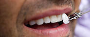 Cosmetic Dentistry - Northern Colorado Dentistry