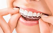 Get the Best Invisible Braces In Mumbai