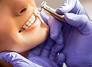 Find the Best Orthodontist in Mumbai for Your Perfect Smile