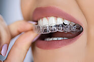 Why Choose Invisalign for Your Teeth Straightening Journey