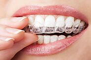 Achieve a Perfect Smile with Invisible Braces