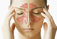 Types of Cures available for Sinusitis!