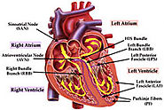 Heart Care | Cardiac Procedures at Apollo Health City