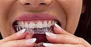 The Benefits of Choosing Invisalign in Cary