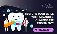 Restore Gum Health with Advanced Periodontal Treatment