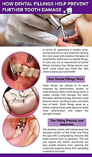 How Dental Fillings Help Prevent Further Tooth Damage