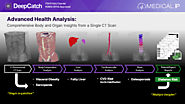 New Medical AI Solution Accurately Predicts Diabetes from CT Image