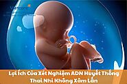 5+ Lợi Ích Của Xét Nghiệm ADN Huyết Thống Thai Nhi Không Xâm Lấn