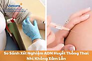 So Sánh Xét Nghiệm ADN Huyết Thống Thai Nhi Không Xâm Lấn với Các Phương Pháp Khác