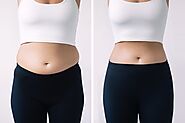 Matchless Surgeries: Body Sculpting & Body Contouring Dubai