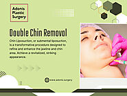 Double Chin Removal