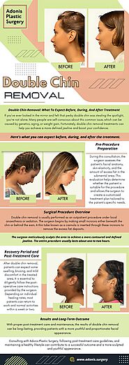 Double Chin Removal