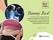 Tummy Tuck