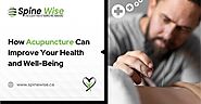 How Acupuncture Can Improve Your Health and Well-Being