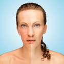 The Debate About Hydroquinone | Aesthetic Advancements