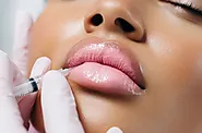 Lip Augmentation in Delhi | Lip Enhancement in Delhi