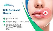 Confusions Between Cold Sores and Herpes! A Detailed Guide